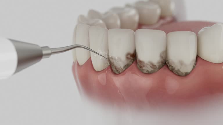 Trusted Dental Implants service in Lithopolis, OH - Dentist Open Now